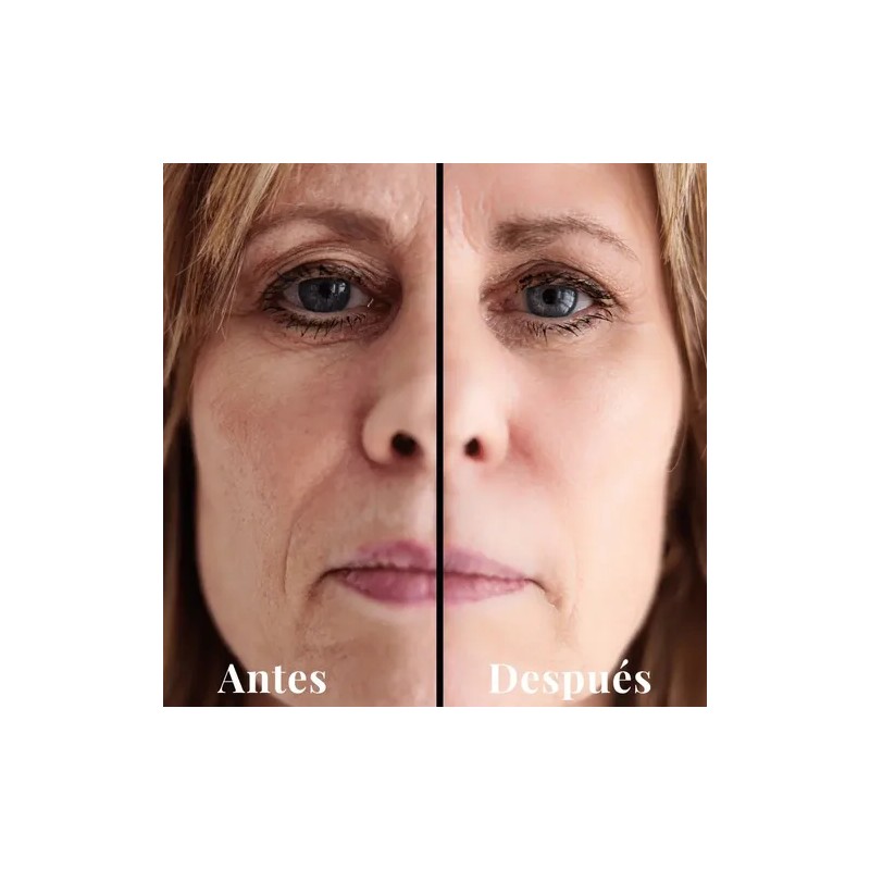Kit Antiedad Y Rejuvenecedor Lilo Skincare Vitamina E