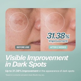 CHARDE Mascarilla de crema para manchas oscuras, máscara de crema a transparente para una piel más brillante y de aspecto más uniforme, rutina de cuid