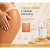 Natura Skin Oil 100ml Aceite Corporal Hidratante Estrías Cicatrices Rosa
