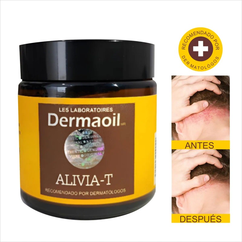 Pomada Natural Para Psoriasis: Hidratación Profunda.