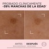 L'Oréal Paris Age Perfect Korrekturserum, schnelle Wirkung, Anti-Flecken, für reife
