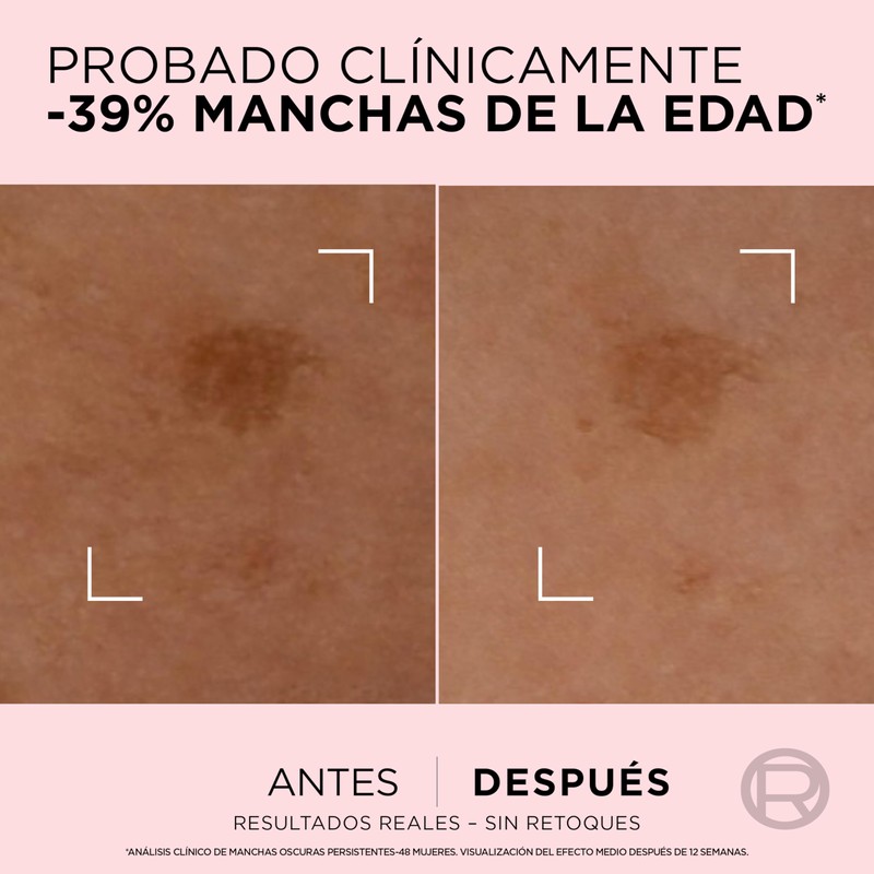 L'Oréal Paris Age Perfect Korrekturserum, schnelle Wirkung, Anti-Flecken, für reife
