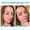 2pz 60ml Pdrn Crema Hidratante Facial Con Acido Hialurónico