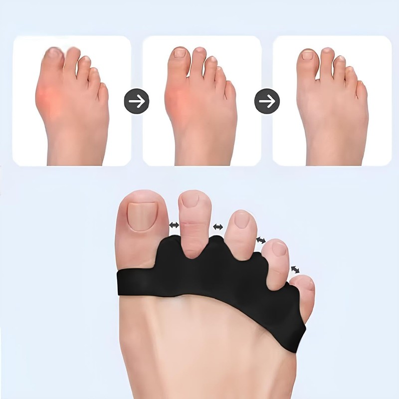 FlexAlign Corrective Toe Spacers - Bunion Relief and Toe Restoration