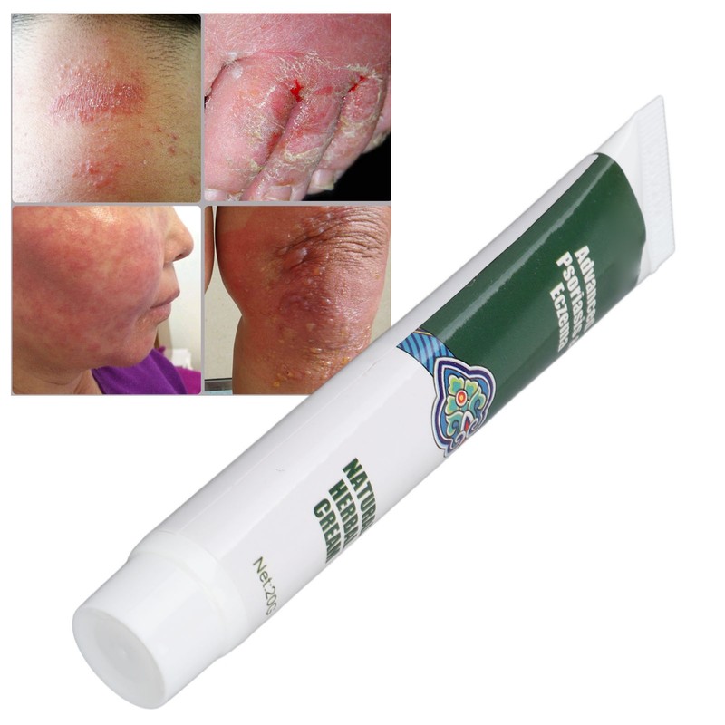 2pcs Hydrating Moisturizing Cream Eczema Erythema Repair Cream Itchy Skin