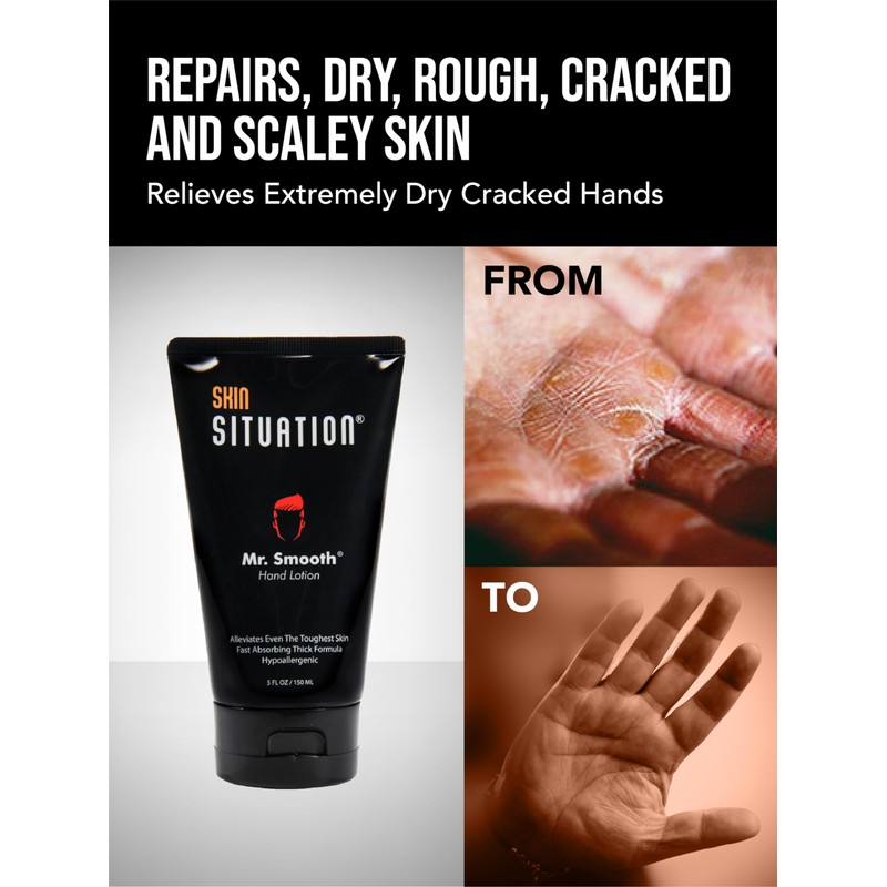 Mr. Smooth Hand Lotion for Dry Skin Relief
