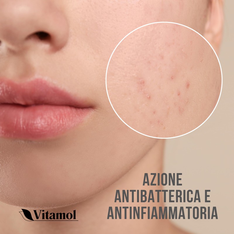 Vitamol Biosoft Pimple, Acne and Blackhead Treatment Cream - 40ml