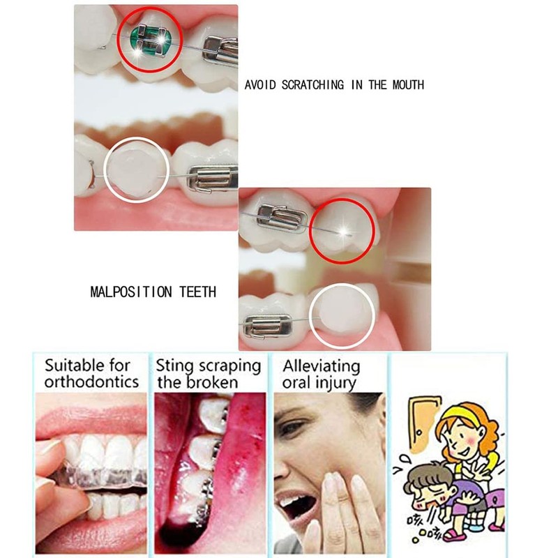 Chargenyang 6 Boxes Dental Oral Care Orthodontics Wax with Fruit