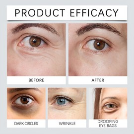 Caffeine Eye Serum Cream for Dark Circles & Puffy Eyes,Anti-Aging Under Eye Serum with 360° Massage Rollerball,Hydrating Eye Cream,Reduce Bags,Wrinkles and Fine Lines,Suitable for Men and Women