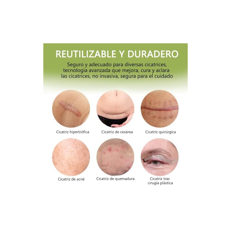 Cinta para eliminar cicatrices(rollo de 4cm x 1.5 m), eliminación