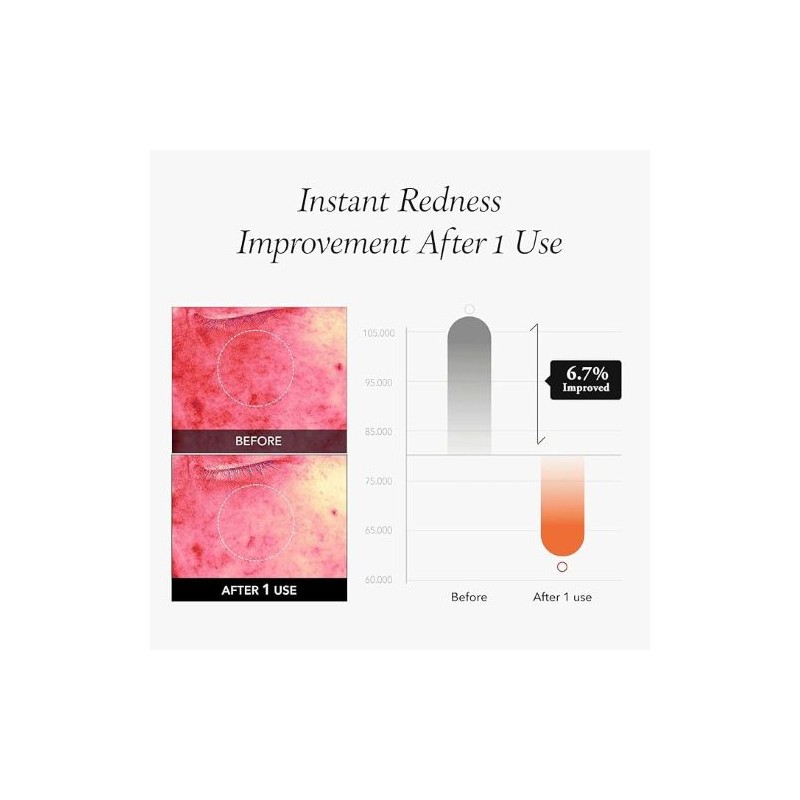 APRILSKIN [APRILSKIN]Carrotene IPMP Instant Calming Serum Pads (80ea)