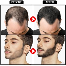 GEUUFEA Beard Pen Filler Styling Kit for Men, 4-tip Beard Filler Pencil (Black), Soft Cotton Tip, Long Lasting Waterproof, Beard Stick Beard Shadow, Beard Shaping Tool for Hairline and Beard Fillers