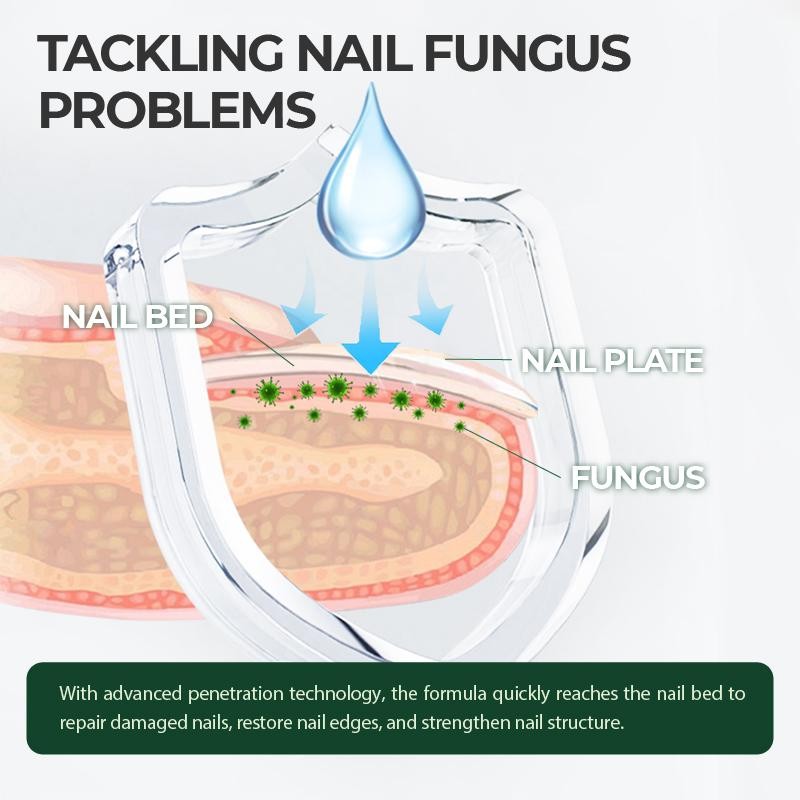 Kreain Multi-Purpose Nail Repair, Nail Solution for Discolored and Damaged