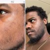 Beard Growth Oil, Rapid Beard Thickening, Plant Based Beard Growth