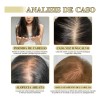 Aceite Estimula Crecimiento Cabello Anticaida Fortalece 60ml