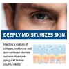 Em Crema Para Ojos Para Hombre Quita Ojeras Arrugas, Retinol