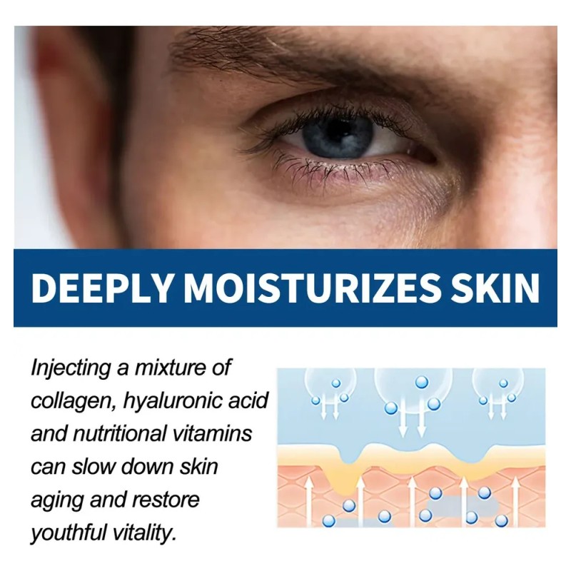 Em Crema Para Ojos Para Hombre Quita Ojeras Arrugas, Retinol