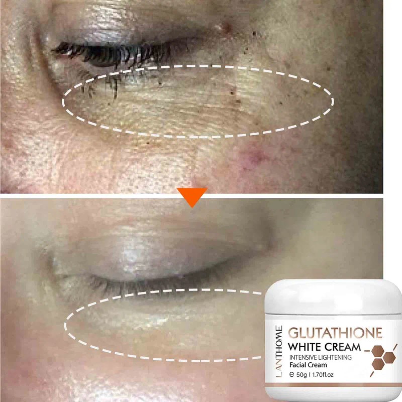 Crema Rejuvenecedora Y Rejuvenecedora Para Ojos V, Hidratant