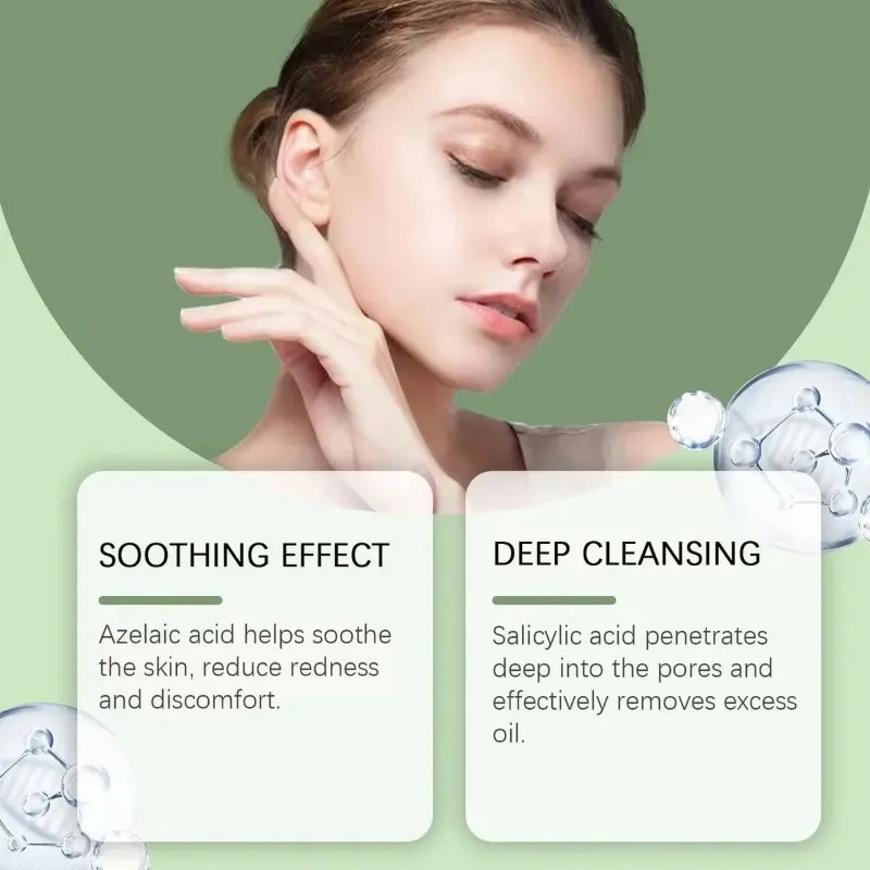 Crema Facial Antiacné, Elimina Profesionalmente Las Marcas D