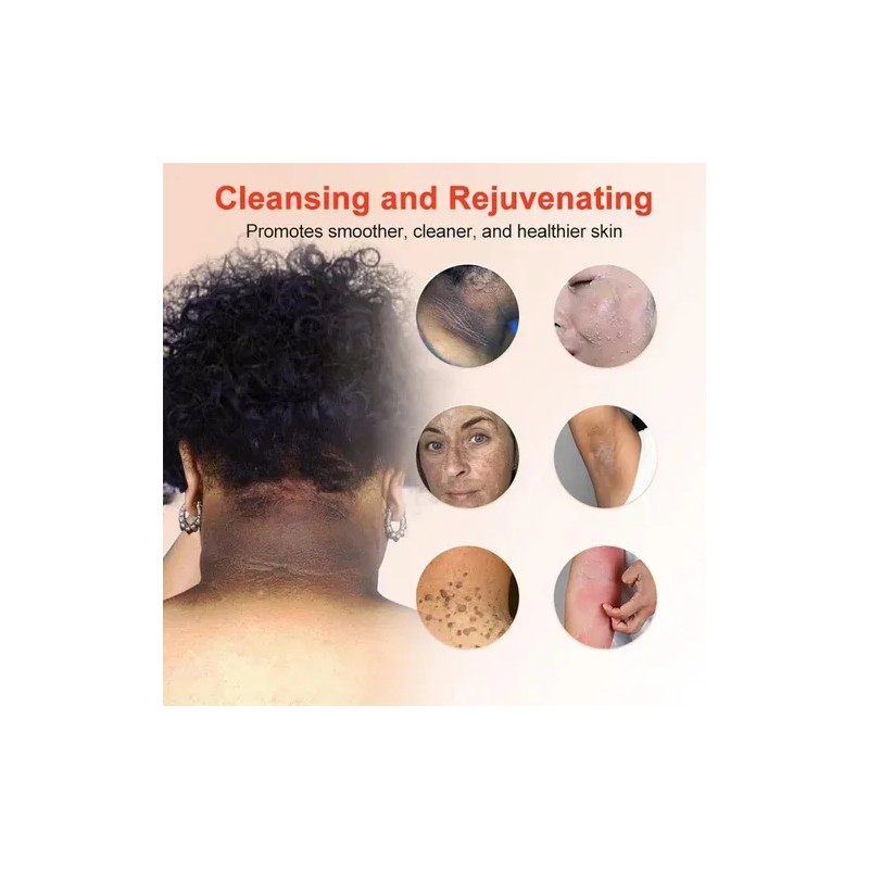 2025 Gel Exfoliante Purificante,exfoliante, Exfoliante Facia