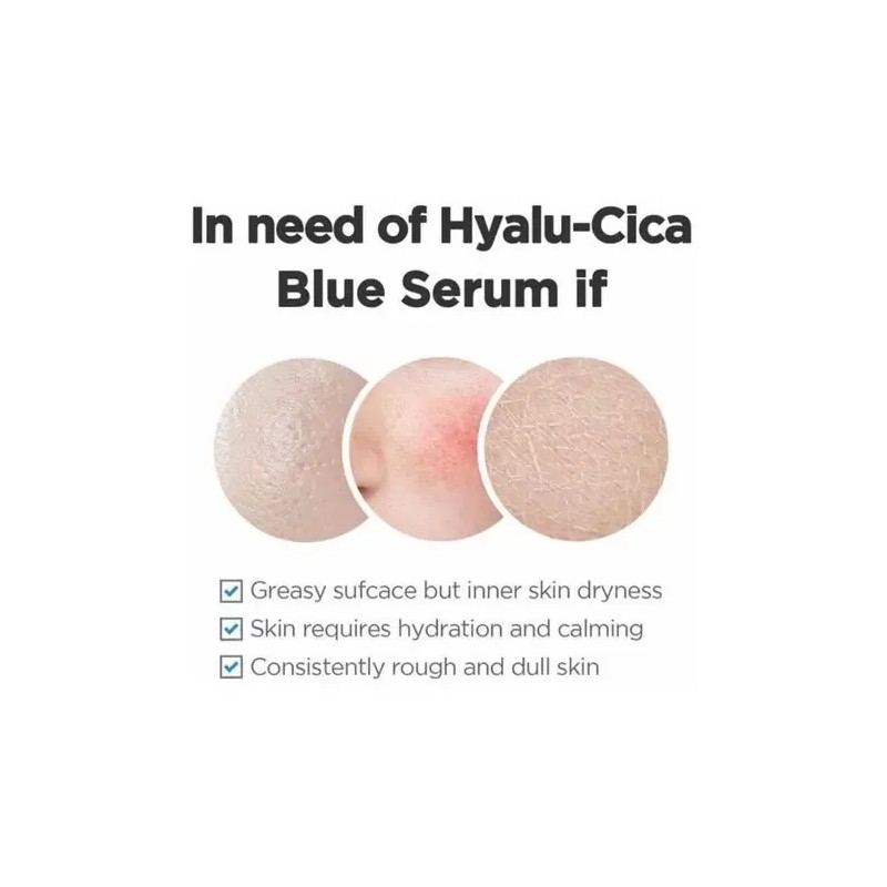 Skin1004 Madagascar Centella Hyalu-cica Blue Serum 50ml Todo Tipo De