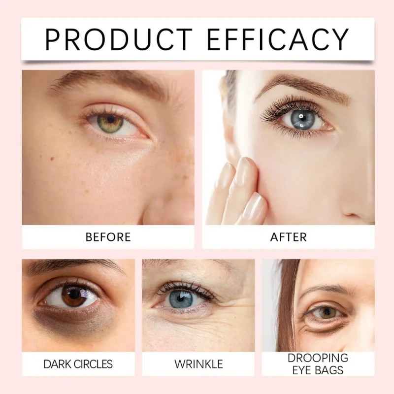 Eye Concealer Can Cover The Dark Defects Which Is Easy