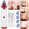 Blackhead Removal Rechargeable 5 Adjustable Suction Electric Pore Acne Cleaner