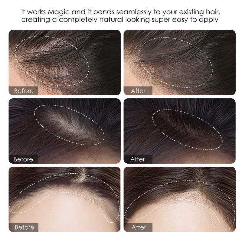 FREEORR Root Touch Up Powder - Hairline Shadow for Thinning