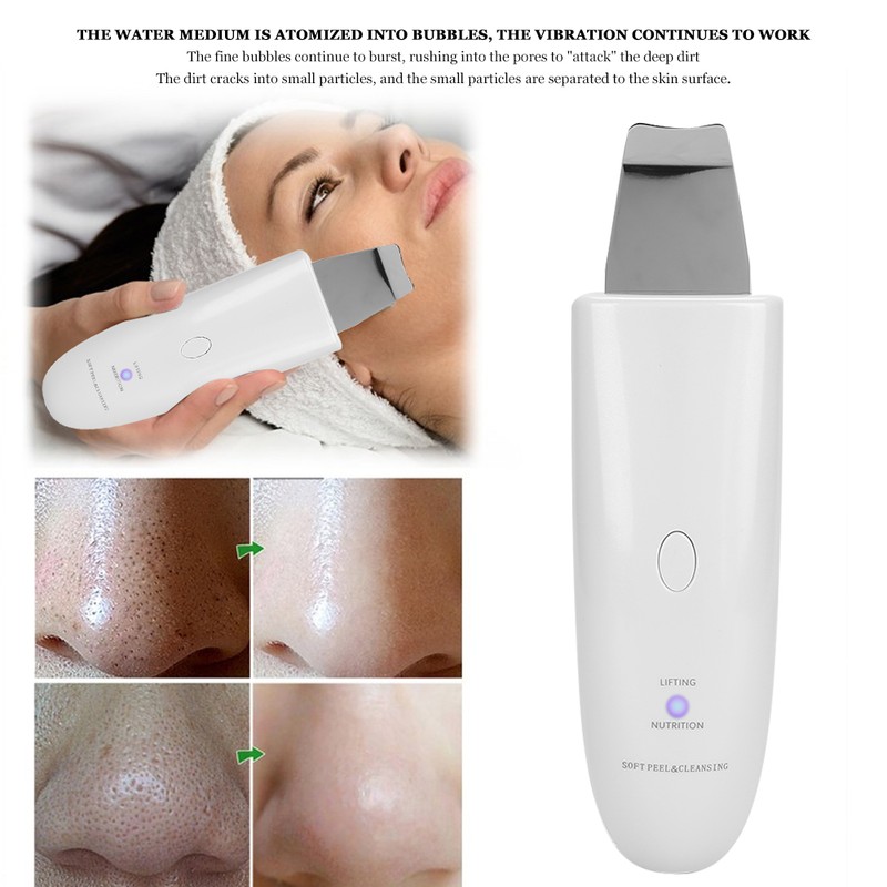 Household Ultrasonic Skin Scrubber Blackhead Removal Face Pore Cleanser InstrumentWhite