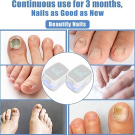 4 PCS UV LED Nail Device, Portable Dual Power Battery/ USB, Low Voltage ≤36V, Rechargeable Lithium Battery, Odorless Treatment for Thick Pigmented Nails, Suitable for Toenails - Color: 2PCS-White*White