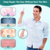 Scar Gel, Scar Cream, Advance Scar Gel for Surgical Scars,Face,Bod<wbr/>y,Leg,