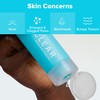 Paula's Choice CLEAR Regular Strength Anti-Redness Exfoliating Solution with 2%