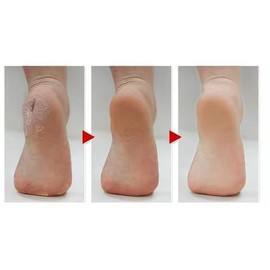 Silicone Moisturizing Socks, Heel Protector, Anti Crack Foot Spa Socks, Pedicure Socks (White Solid Large)