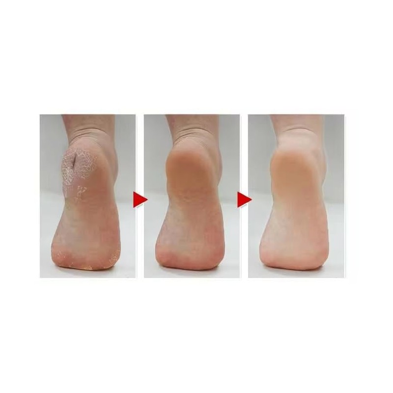 Silicone Moisturizing Socks, Heel Protector, Anti Crack Foot Spa Socks,