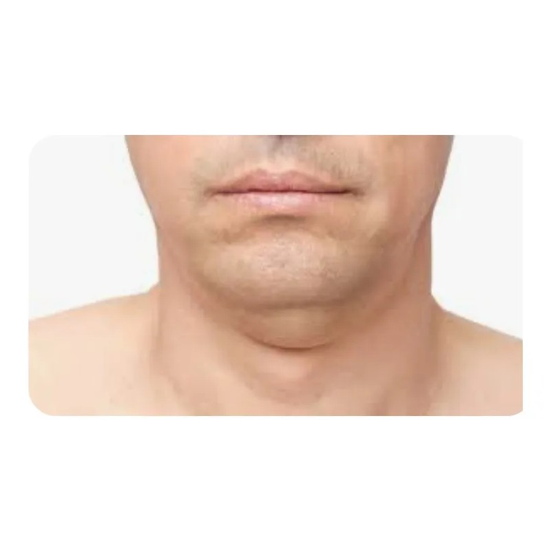 Crema Para Reducir Papada Tonificar Cuello Adelgaza Reafirma Fresh