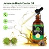 Aceite De Ricino Negro (2 Unidades) Para El Cabello//*