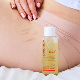 Topicrem - CICA+ Concentrated Oil for Stretch Marks and Scars - Steamed, Helps Prevent, Soothes, Moisturises 24 Hours - Face & Body Care for Sensitive Skin - Non