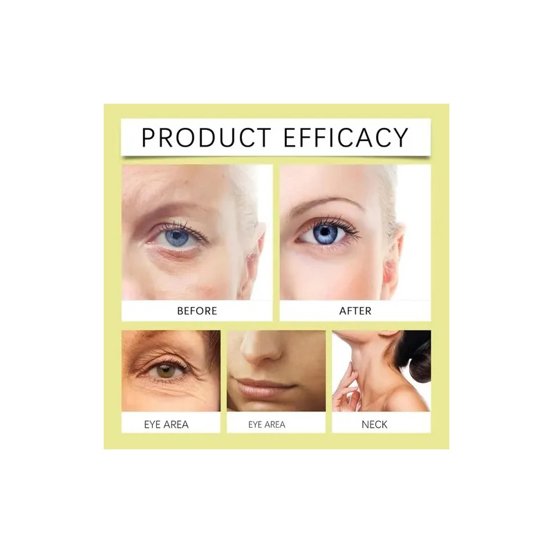 2026 [seleccin] 3 Unids-celimax The Vita A Retinal Shot, Zj