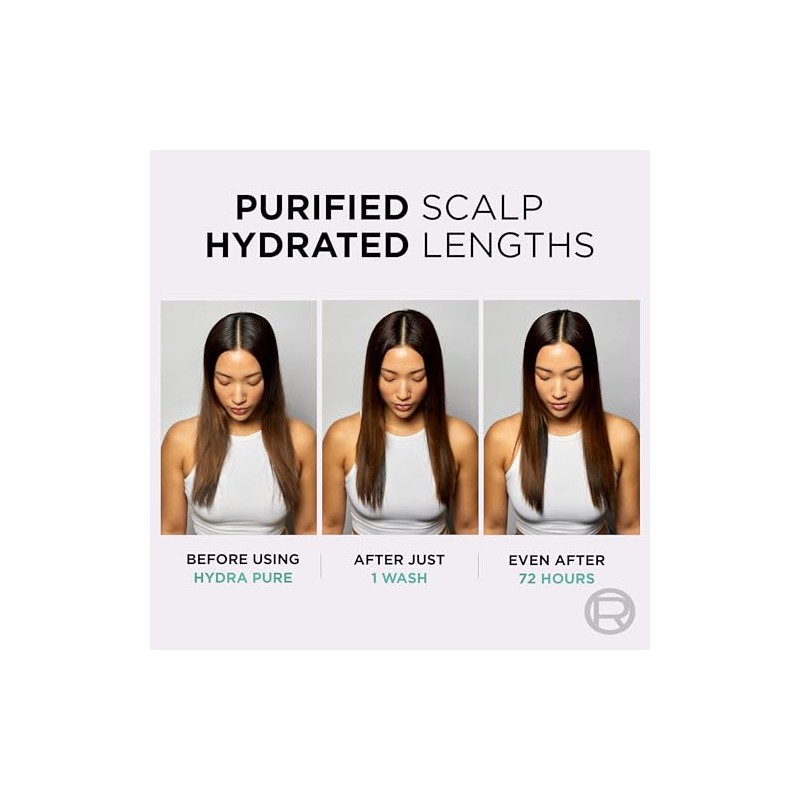 L’Oréal Paris Elvive Hydra Pure, Oil control Scalp serum, 102ml