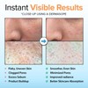 Ebanel Brightening Peeling Gel with Cotton Cellulose, Rice, Papaya, Centella,