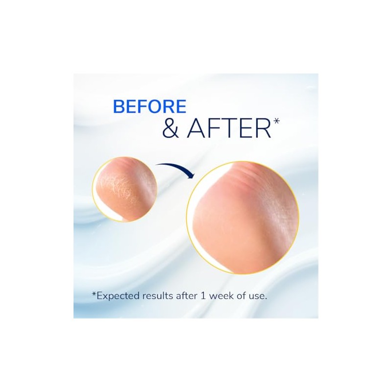 Dr. Scholl's Bálsamo reparador de talón agrietado, 2.5 onzas, con
