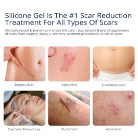100% Silicone Scar Gel 3-Pack – 3 x 1.06oz Scar Cream for Long-Term Scar Care – C-Section, Surgery, Acne, Keloids, Burns – Fades Old & New Scars Fast