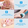 Hsthe Sea Pack of 10 Extra Coarse Mineral Replacement Rollers