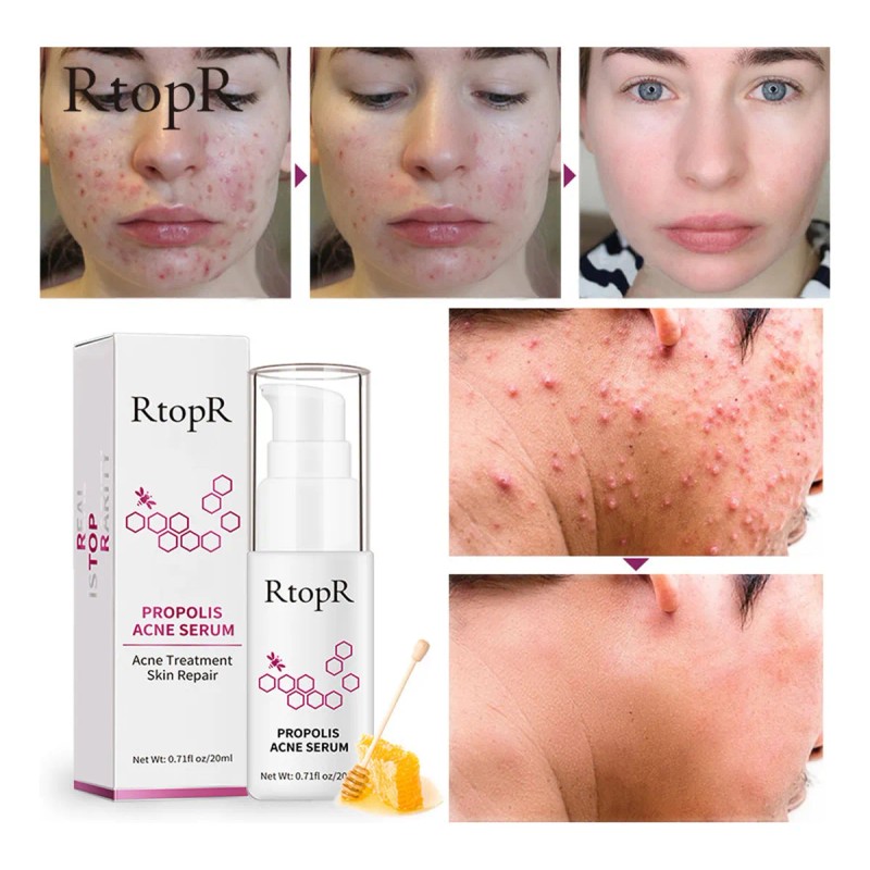 J Propolis Anti-hidratante Y Nutritivo 3015