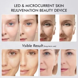 Age Anti-aging Home Pro Booster Device Beauty Skincare                                                                                                