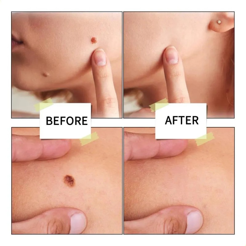 Crema De Tratamiento Para La Piel 3bee B.