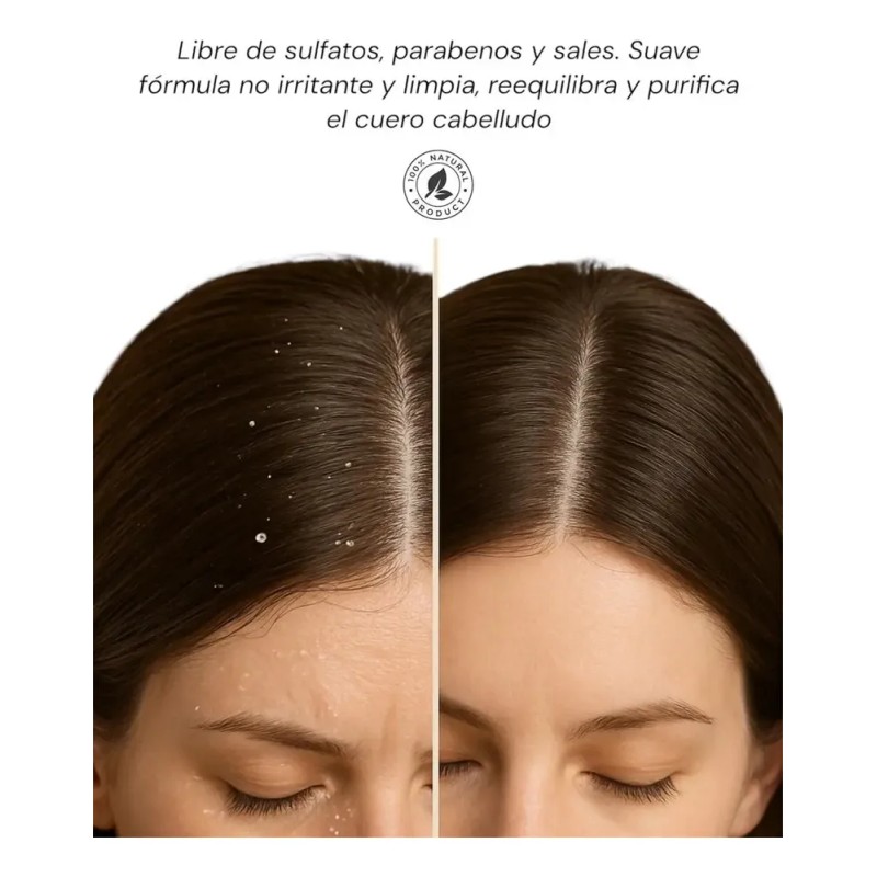 Shampoo Anticaspa Terramar Control Total De Caspa Muy Eficaz
