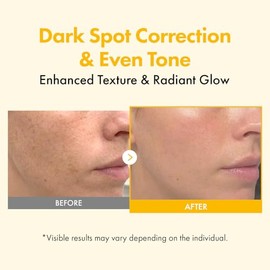 TOSOWOONG Kojic Acid Turmeric Overnight Wrapping Mask, 80% Turmeric Peel Off Facial Mask for Glass Skin, Niacinamide, Retinol & Vitamin C for Dark Spo