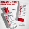 Thayers Blemish Clearing Salicylic Acid Toner, Acne Treatment Face Toner