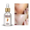 Rorec Serum Arroz Blanco Ácido Hialurónico Reduce Poros